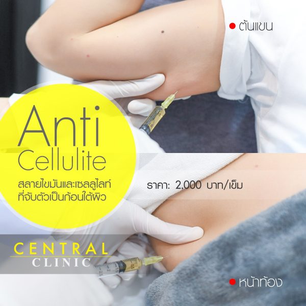 Anti Cellulite 1 เข็ม