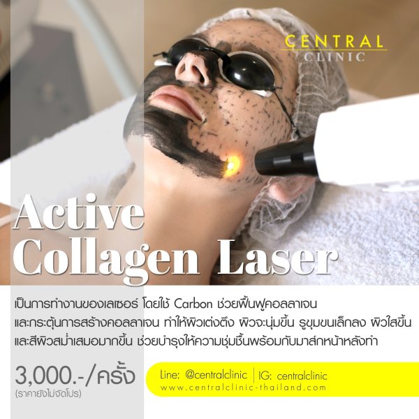Active Collagen Laser