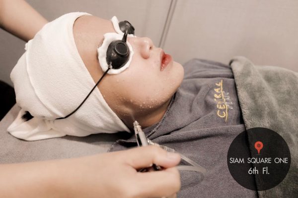 Jet Peel Detox