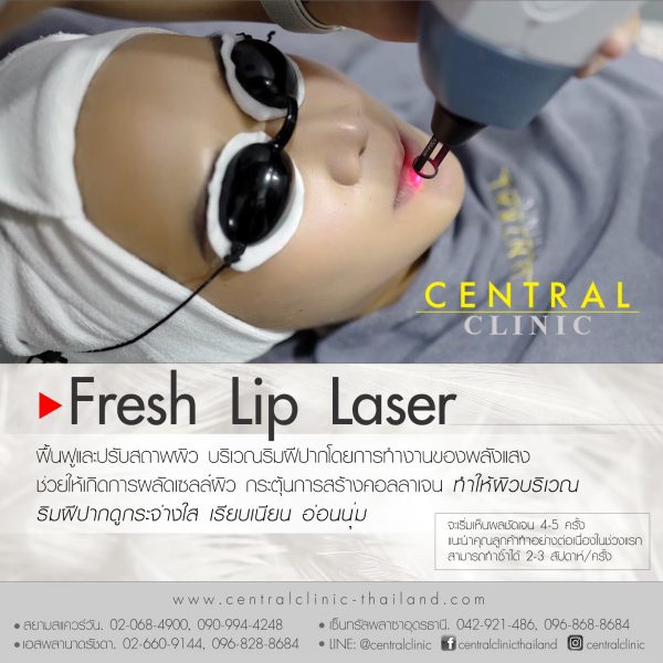 Fresh Lip Laser