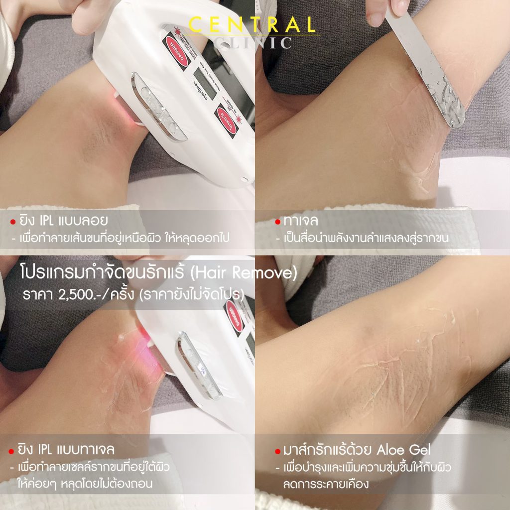 Ad Clinic, MAP_๒๑๐๔๒๒_0_1