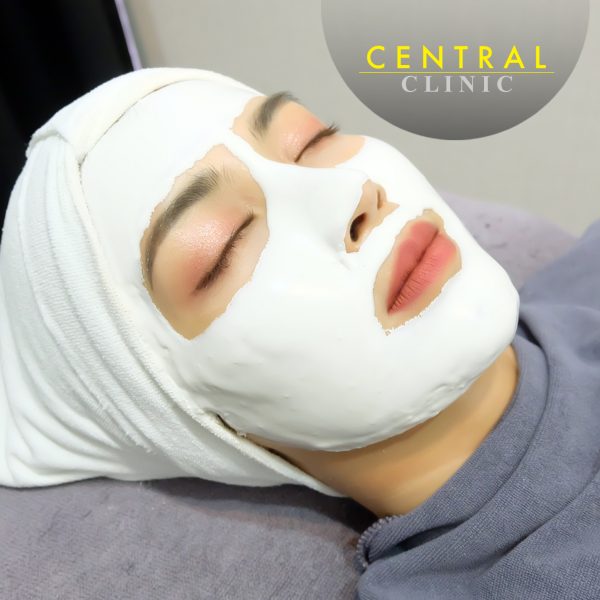 Re-Whitening