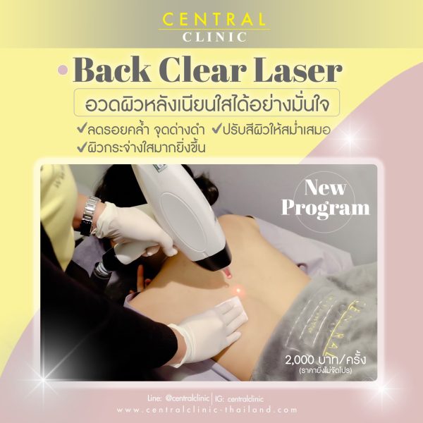 Back Clear Laser