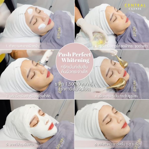 Push Perfect Whitening