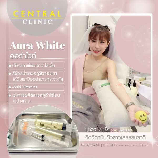 Aura White 1 ครั้ง
